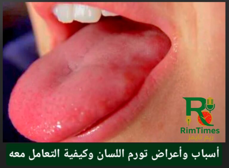 ٢٠٢٥٠٨١٣_٠٠٤٠٠٣